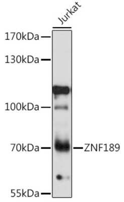 Western Blot: ZNF189 AntibodyAzide and BSA Free [NBP2-95186]