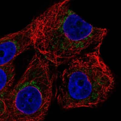 Immunocytochemistry/ Immunofluorescence: ZNF19 Antibody [NBP2-56078]