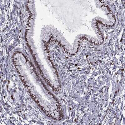 Immunohistochemistry-Paraffin: ZNF19 Antibody [NBP2-56078]