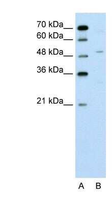 Western Blot: ZNF19 Antibody [NBP1-53031]