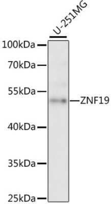 Western Blot: ZNF19 AntibodyAzide and BSA Free [NBP2-94683]