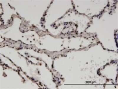 Immunohistochemistry-Paraffin: ZNF192 Antibody (3B10) [H00007745-M10]