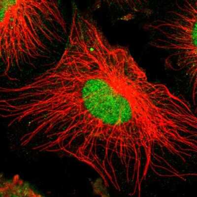 Immunocytochemistry/ Immunofluorescence: ZNF192 Antibody [NBP1-82840]