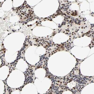 Immunohistochemistry-Paraffin: ZNF192 Antibody [NBP1-82840]