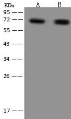 Western Blot: ZNF192 Antibody [NBP3-12709]