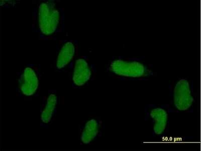 Immunocytochemistry/ Immunofluorescence: ZNF193 Antibody [H00007746-B01P]