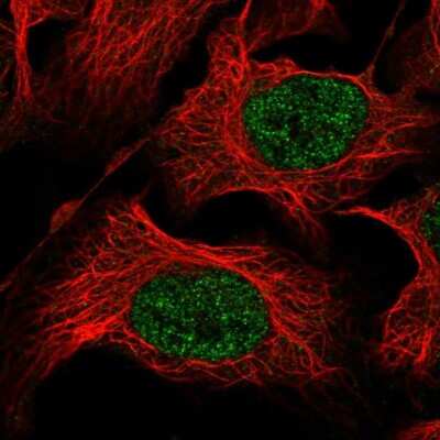 Immunocytochemistry/ Immunofluorescence: ZNF193 Antibody [NBP2-31579]