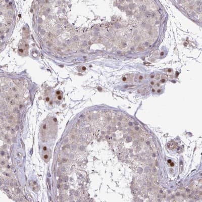 Immunohistochemistry-Paraffin: ZNF193 Antibody [NBP2-31579]