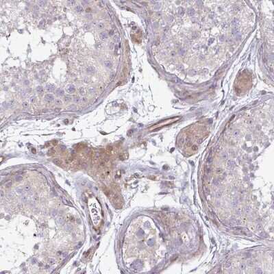 Immunohistochemistry-Paraffin: ZNF193 Antibody [NBP2-31803]