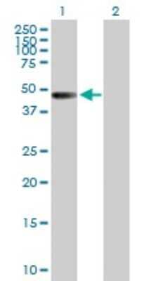 Western Blot: ZNF193 Antibody [H00007746-B01P]