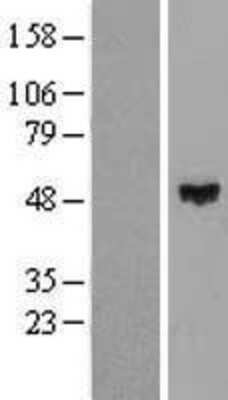 Western Blot: ZNF193 Overexpression Lysate [NBL1-18078]