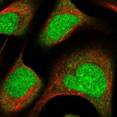 Immunocytochemistry/ Immunofluorescence: ZNF195 Antibody [NBP1-86338]