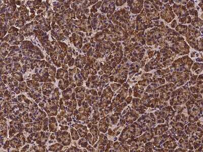 Immunohistochemistry-Paraffin: ZNF195 Antibody [NBP2-98092]