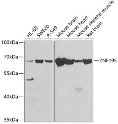 Western Blot: ZNF195 AntibodyBSA Free [NBP2-93054]