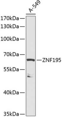 Western Blot: ZNF195 AntibodyBSA Free [NBP2-94807]