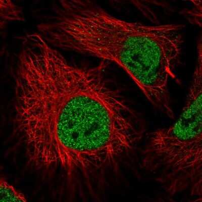 Immunocytochemistry/ Immunofluorescence: ZNF197 Antibody [NBP2-30999]