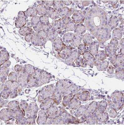 Immunohistochemistry: ZNF197 Antibody [NBP2-30999]
