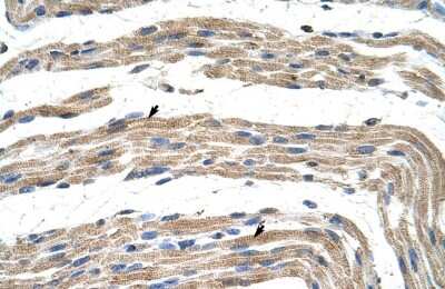 Immunohistochemistry: ZNF197 Antibody [NBP2-86450]