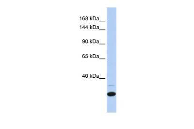 Western Blot: ZNF197 Antibody [NBP2-86449]