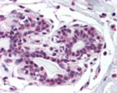 Immunohistochemistry-Paraffin: ZNF198 Antibody [NB100-56490]