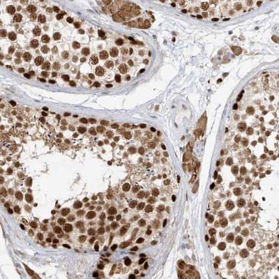 Immunohistochemistry-Paraffin: ZNF198 Antibody [NBP1-84685]