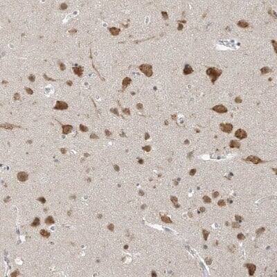 Immunohistochemistry-Paraffin: ZNF198 Antibody [NBP1-84685]