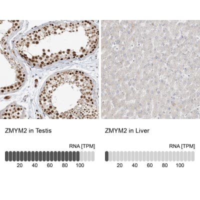 Immunohistochemistry-Paraffin: ZNF198 Antibody [NBP1-84685]