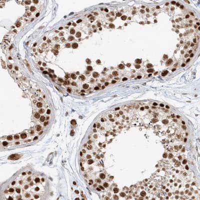 Immunohistochemistry-Paraffin: ZNF198 Antibody [NBP1-84685]
