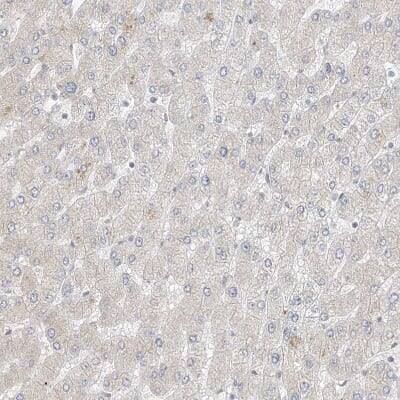 Immunohistochemistry-Paraffin: ZNF198 Antibody [NBP1-84685]