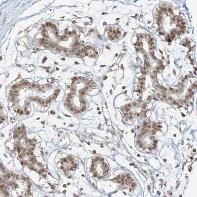Immunohistochemistry-Paraffin: ZNF198 Antibody [NBP1-84685]