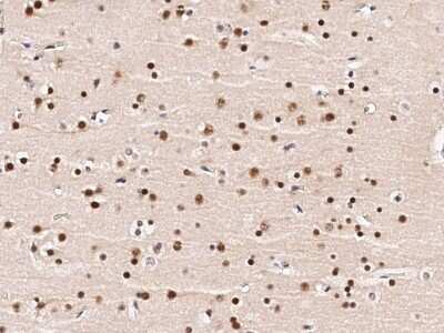 Immunohistochemistry-Paraffin: ZNF198 Antibody [NBP2-95284]