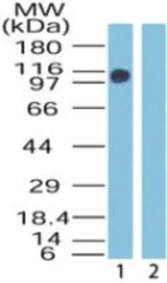 Western Blot: ZNF198 Antibody [NB100-56490]