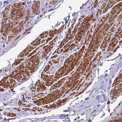 Immunohistochemistry: ZNF2 Antibody [NBP1-89340]