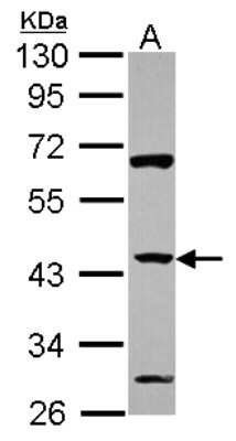 Western Blot: ZNF2 Antibody [NBP2-20973]