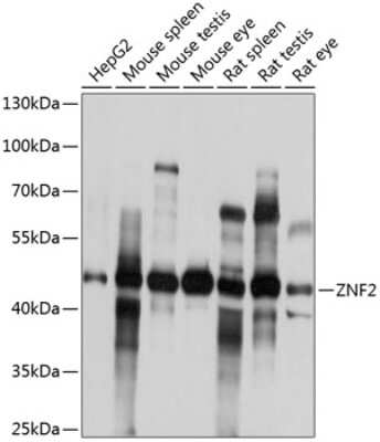 Western Blot: ZNF2 AntibodyBSA Free [NBP2-93369]