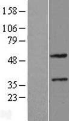 Western Blot: ZNF2 Overexpression Lysate [NBL1-18079]