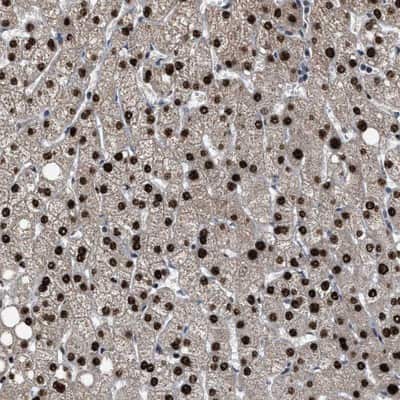 Immunohistochemistry-Paraffin: ZNF20 Antibody [NBP1-81347]