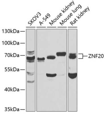 Western Blot: ZNF20 AntibodyBSA Free [NBP2-93053]