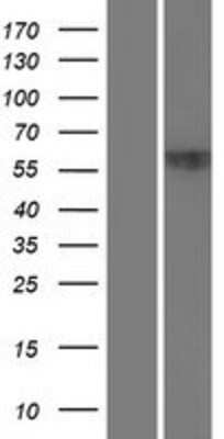 Western Blot: ZNF20 Overexpression Lysate [NBP2-06559]