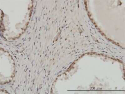 Immunohistochemistry-Paraffin: ZNF202 Antibody (1E9) [H00007753-M01]