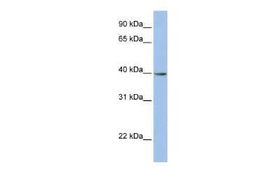 Western Blot: ZNF202 Antibody [NBP2-84349]