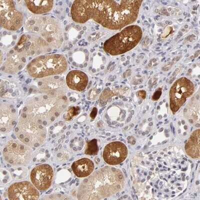 Immunohistochemistry-Paraffin: ZNF205 Antibody [NBP1-80604]