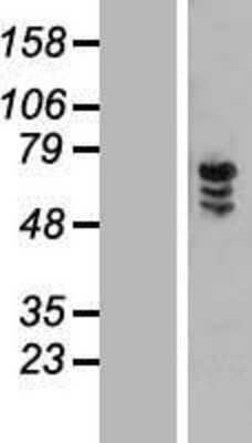 Western Blot: ZNF205 Overexpression Lysate [NBL1-18084]