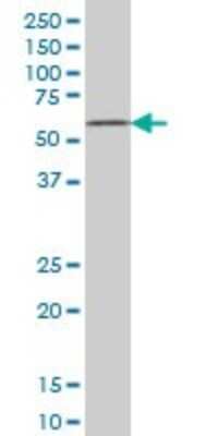 Western Blot: ZNF207 Antibody (6D7) [H00007756-M06]