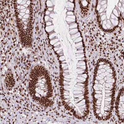 Immunohistochemistry: ZNF207 Antibody [NBP2-39010]