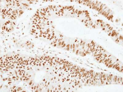 Immunohistochemistry-Paraffin: ZNF207 Antibody [NBP2-20974]