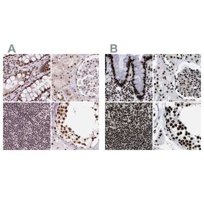 Immunohistochemistry-Paraffin: ZNF207 Antibody [NBP2-39010]