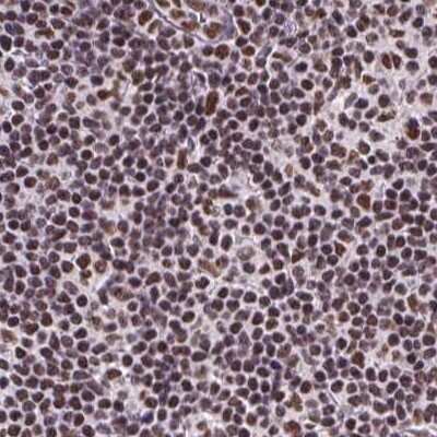 Immunohistochemistry-Paraffin: ZNF207 Antibody [NBP2-39010]