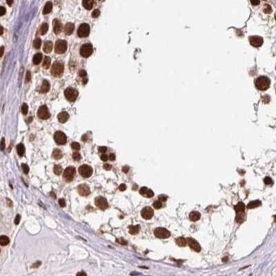 Immunohistochemistry-Paraffin: ZNF207 Antibody [NBP2-39010]