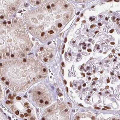 Immunohistochemistry-Paraffin: ZNF207 Antibody [NBP2-39010]
